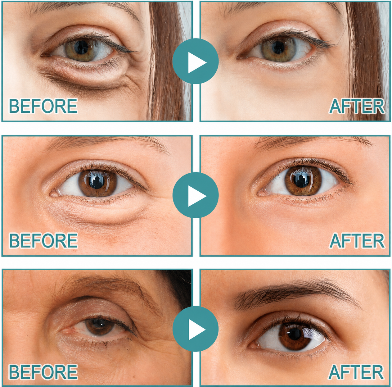 Shopanai | Dissolving Microneedle Eye Patches
