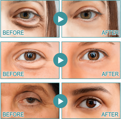 Shopanai | Dissolving Microneedle Eye Patches