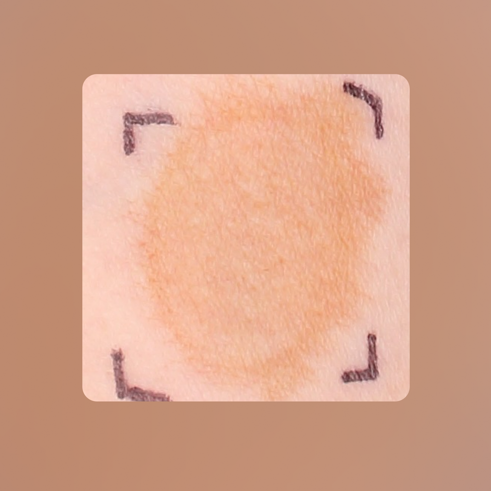 Resurfacing Exfoliator