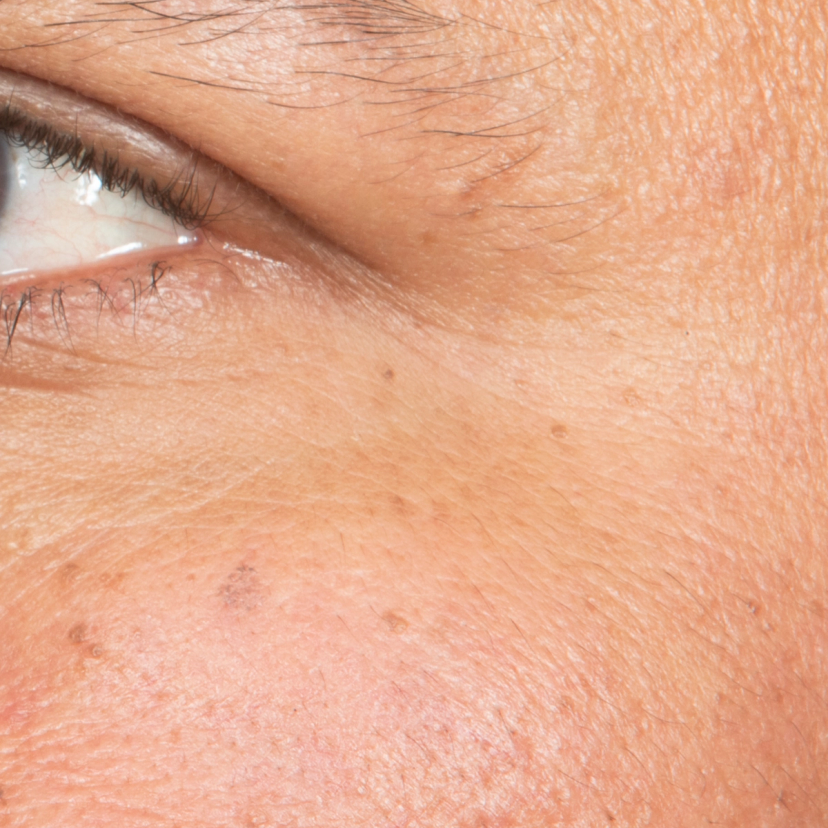 Eye Cream