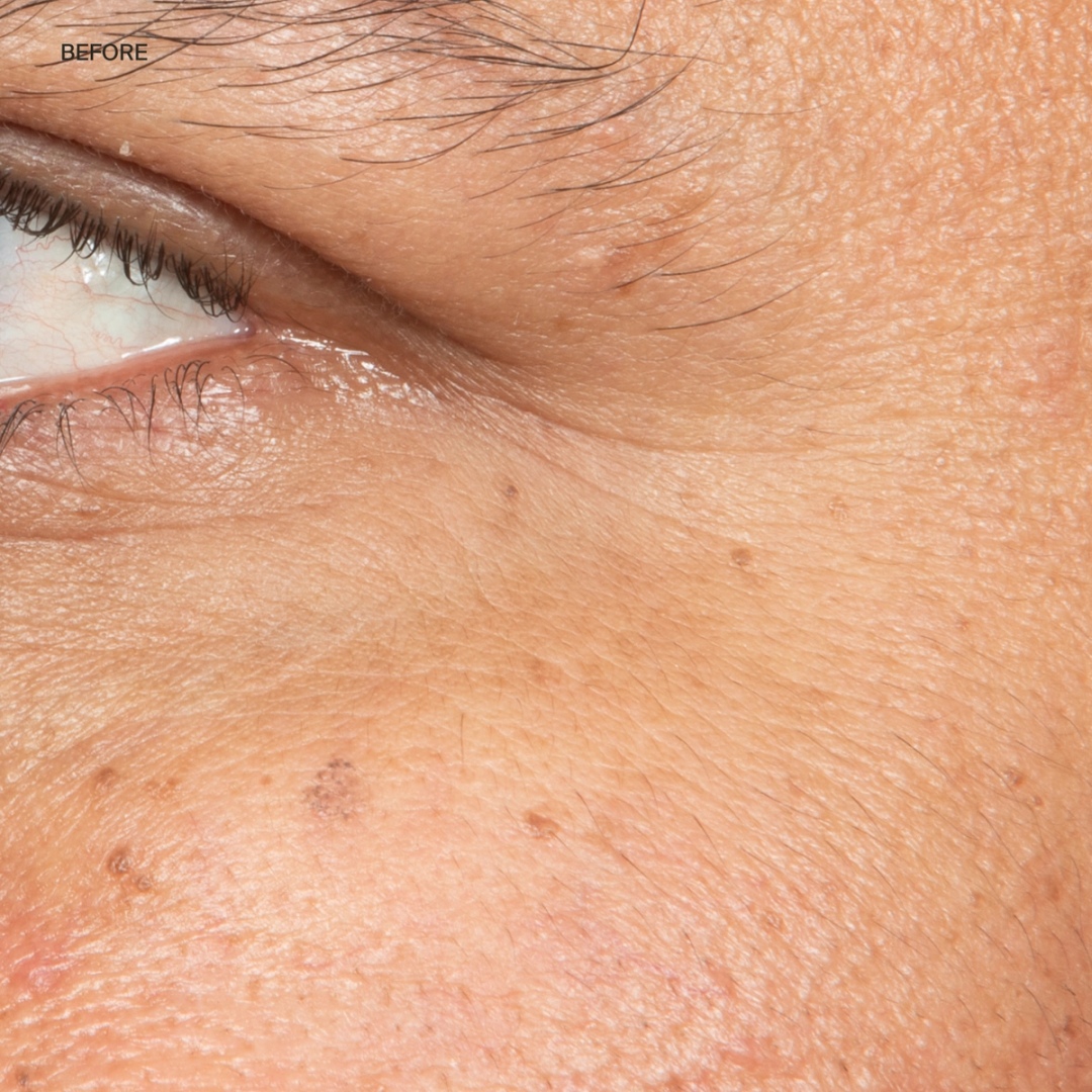 Eye Cream