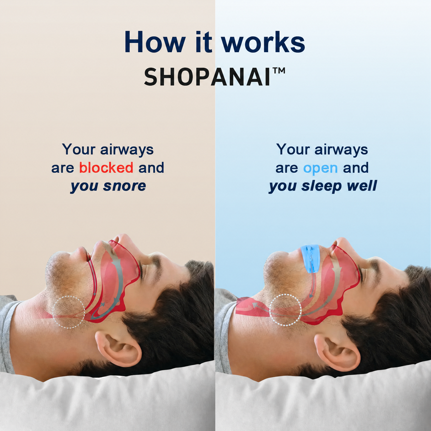 SHOPANAI™  Professional intelligent anti-snoring device